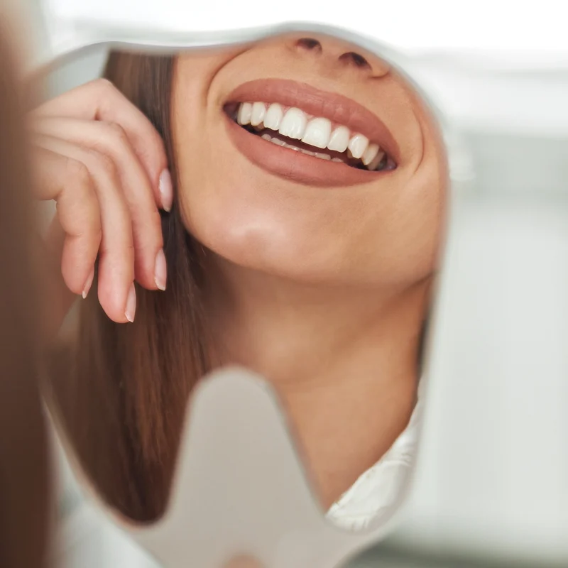 in-office bleaching düsseldorf professionelle zahnaufhellung zahnarzt